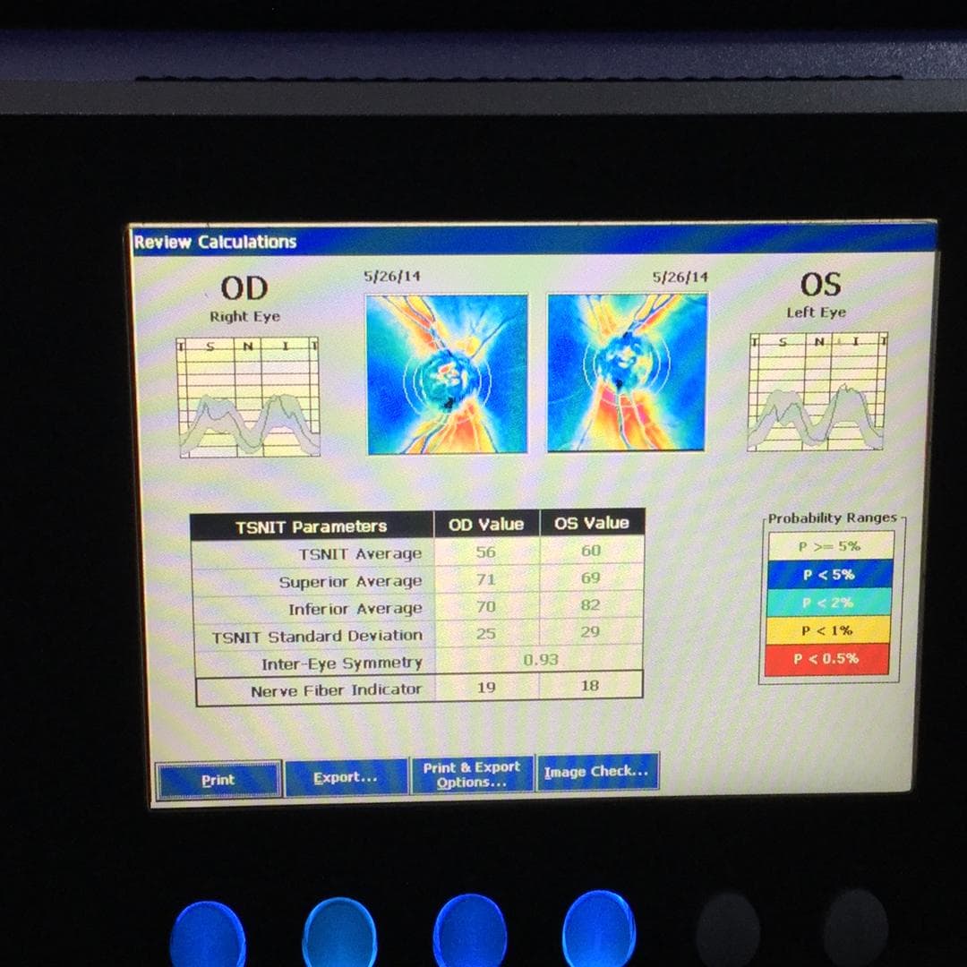 Non-Contact Tonometry